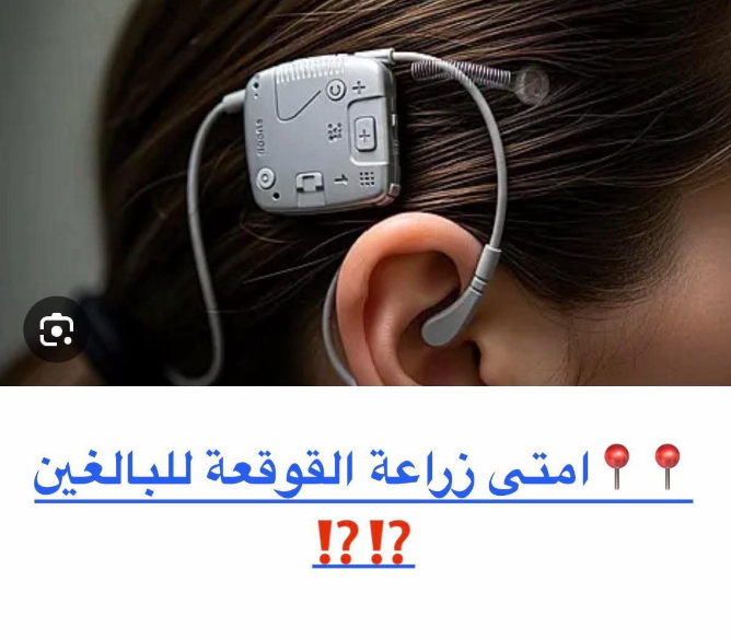 هل زراعة القوقعة تنفع للكبار؟